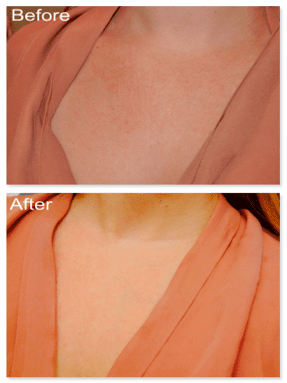 I wish you could feel texture through pictures!! The texture is totally different in the "After" picture. Sorry the lighting is slightly darker in the top pic.